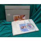 Acarex gyermek antibakteriális ágynemű